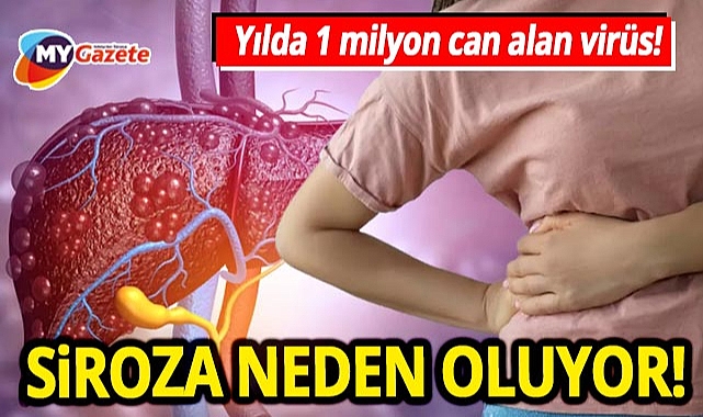 yilda-1-milyon-can-alan-virus-tedavi-edilmezse-siroza-neden-oluyor-2994.jpg