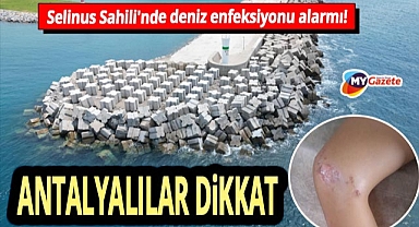Gazipaşa Selinus Sahili'nde deniz enfeksiyonu alarmı! 9 yaşındaki çocuk rahatsızlandı!