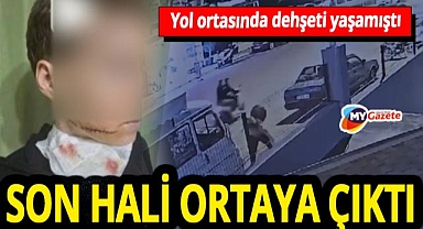 Genç kadına kabusu yaşatmıştı! Son hali ortaya çıktı