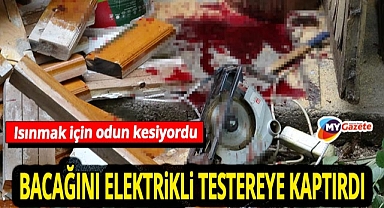 Antalya’da talihsiz kaza! Yaşlı adam odun keserken bacağını testereye kaptırdı