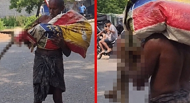 Akıllara durgunluk veren olay! Banka parayı vermeyince kız kardeşinin iskeletini şubeye götürdü