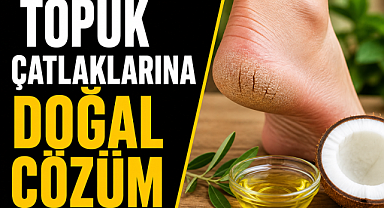 Topuk çatlaklarına doğal çözüm: Ceviz kabuğu yöntemi gündemde