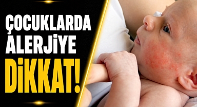 Uzmanlardan kritik uyarı! Çocuklarda besin alerjisi 'yeni pandemi' oldu
