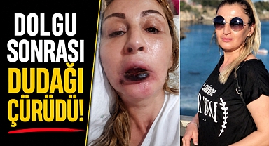 Estetik işlem sonrası dudağı çürüdü, 7 yıldır hukuk mücadelesi veriyor