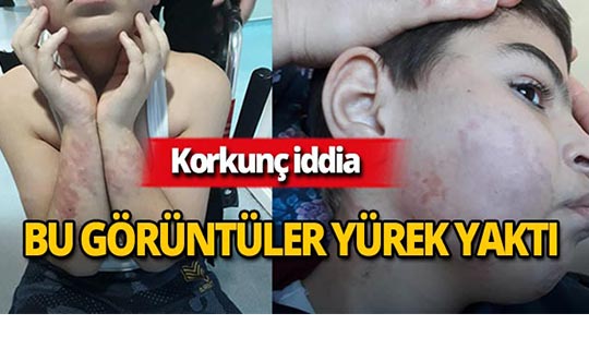 10 yaşındaki çocuğun yürek yakan görüntüleri!