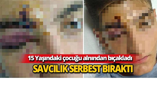 15 yaşındaki çocuğu alnından bıçakladı serbest kaldı