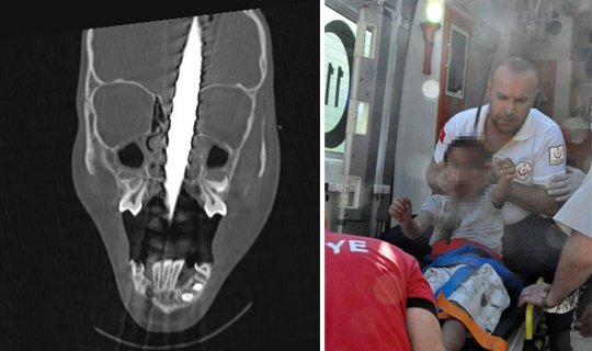 Ağzından giren demir başından çıkmıştı, Fırat'ın durumu ne oldu?