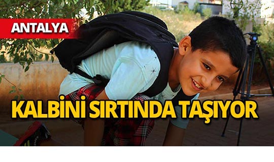 Antalya'da 8 yaşındaki çocuk kalbini sırtında taşıyor