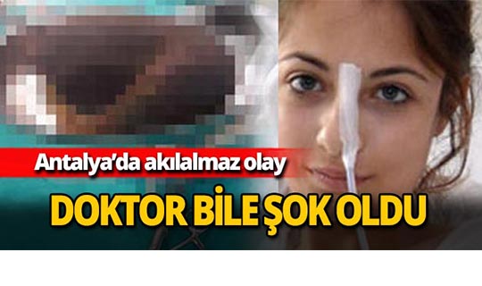 Antalya'da doktor bile şok oldu