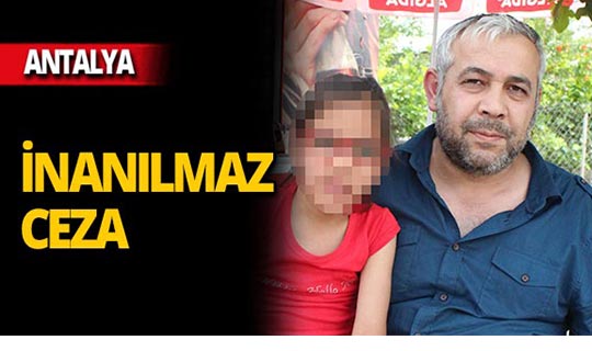 Antalya'da şoke eden iddia: 'Kızgın maşa ile parmağını yaktı'
