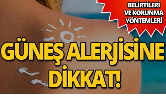 Güneş alerjisi nedir? Belirtileri ve tedavi yöntemleri nelerdir?