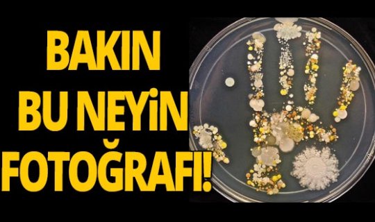 Laborant bir anne çocuğunun elinde tespit etti