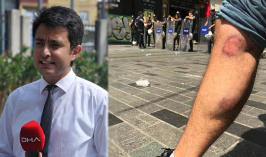 Muhabire görevi sırasında gazlı mermi sıktılar