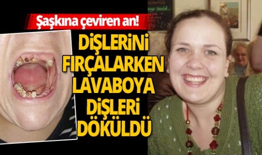 Ne olduğunu anlayamadı! Dişlerini fırçalarken dişsiz kaldı