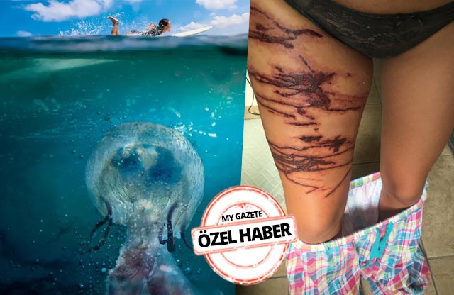 Ege, Akdeniz ve Marmara’yı hızla işgal ediyorlar! Sahillerimiz büyük tehlike altında...